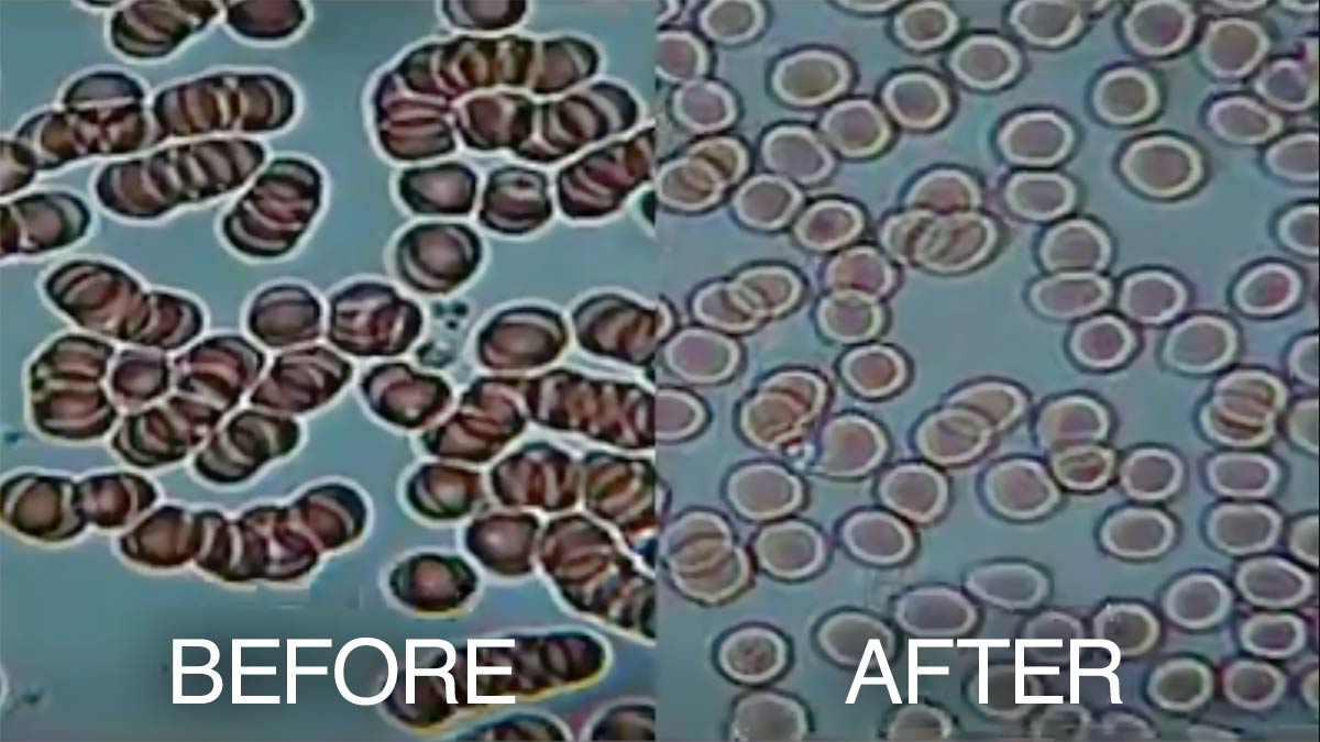 kangen-water-blood-test